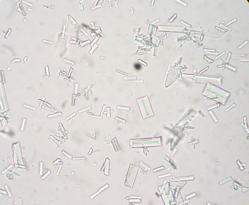 Struvite