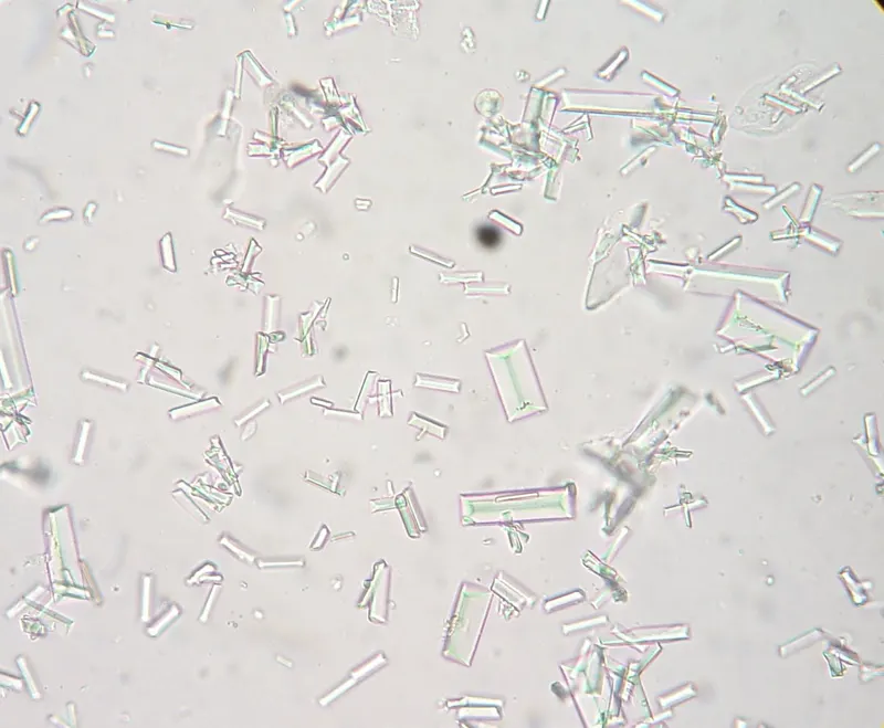 Struvite crystals dog 1.JPG