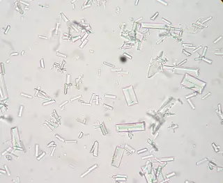 Struvite crystals dog 1.JPG