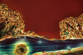 Urea crystals