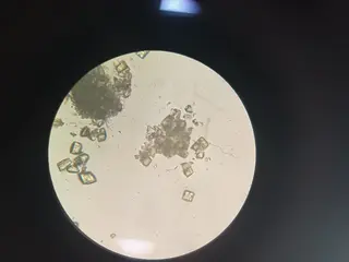 Uric acid6.jpg